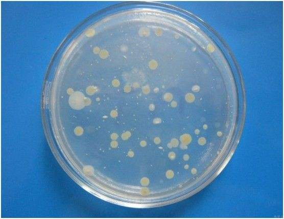 菌落總數,水質在線大菠萝导航在线观看